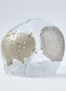 Titanium Mesh-1